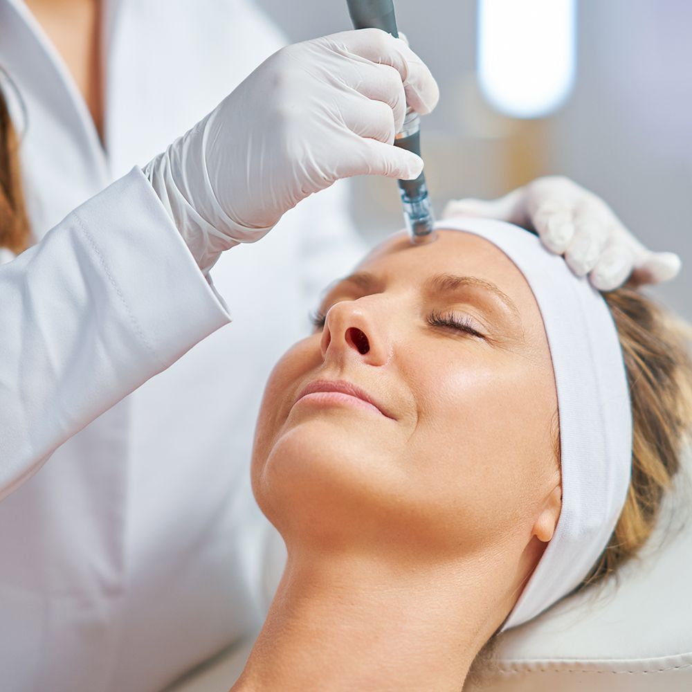 PRP/PRF Microneedling